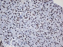 DCPS Mouse anti-Human, Clone: OTI1E6, lyophilized, TrueMAB 100 &mu;g; Unconjugated:Antibodies,