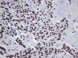 DCPS Mouse anti-Human, Clone: OTI1E6, lyophilized, TrueMAB 100 &mu;g; Unconjugated:Antibodies,