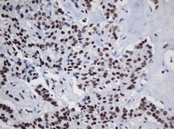 DCPS Monoclonal Antibody (OTI1E6), TrueMAB , OriGene 100 &mu;L; Unconjugated:Antibodies,