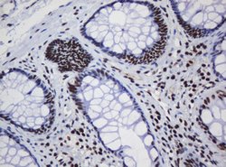 DCPS Mouse anti-Human, Clone: OTI1E6, lyophilized, TrueMAB 100 &mu;g; Unconjugated:Antibodies,