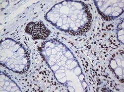 DCPS Monoclonal Antibody (OTI1E6), TrueMAB , OriGene 100 &mu;L; Unconjugated:Antibodies,
