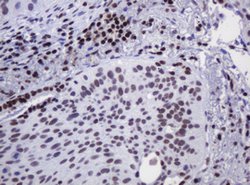 DCPS Mouse anti-Human, Clone: OTI4H8, lyophilized, TrueMAB 100 &mu;g; Unconjugated:Antibodies,