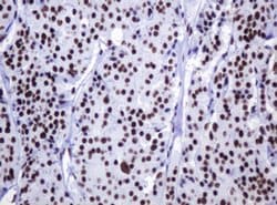 DCPS Monoclonal Antibody (OTI4H8), TrueMAB , OriGene 100 &mu;L; Unconjugated:Antibodies,