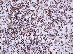 DCPS Mouse anti-Human, Clone: OTI4H8, lyophilized, TrueMAB 100 &mu;g; Unconjugated:Antibodies,
