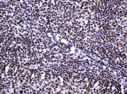 DCPS Mouse anti-Human, Clone: OTI4H8, lyophilized, TrueMAB 100 &mu;g; Unconjugated:Antibodies,