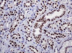 DCPS Monoclonal Antibody (OTI4H8), TrueMAB , OriGene 100 &mu;L; Unconjugated:Antibodies,