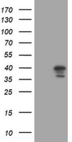 DCPS Monoclonal Antibody (OTI1E6), TrueMAB , OriGene:Antibodies:Primary