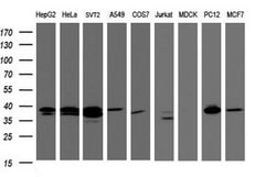 DCPS Mouse anti-Human, Clone: OTI1E6, lyophilized, TrueMAB 100 &mu;g; Unconjugated:Antibodies,