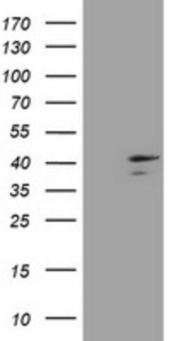 DCPS Mouse anti-Human, Clone: OTI4H8, lyophilized, TrueMAB 100 &mu;g; Unconjugated:Antibodies,