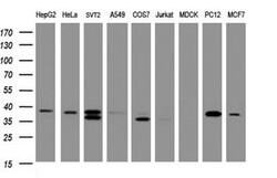 DCPS Mouse anti-Human, Clone: OTI4H8, lyophilized, TrueMAB 100 &mu;g; Unconjugated:Antibodies,