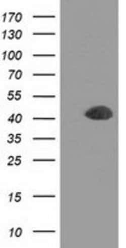 DCX Mouse anti-Human, Clone: OTI4A3, lyophilized, TrueMAB 100 &mu;g; Unconjugated:Antibodies,