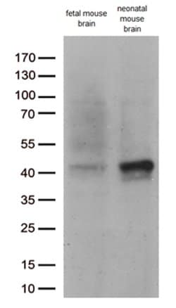 DCX Mouse anti-Human, Clone: OTI4A3, lyophilized, TrueMAB 100 &mu;g; Unconjugated:Antibodies,