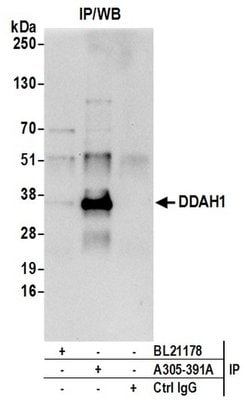 DDAH1 Rabbit anti-Human, Polyclonal, Bethyl Laboratories 10 &mu;L; Unconjugated:Antibodies,