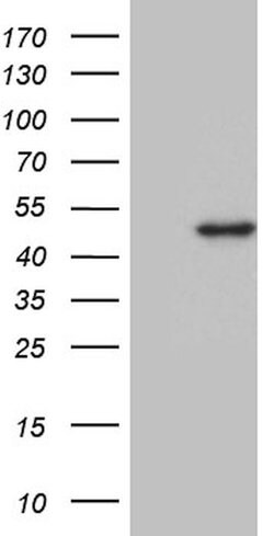 DDB2 Mouse anti-Human, Clone: OTI2E12, lyophilized, TrueMAB 100 &mu;g;