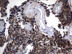 DDIT3 Monoclonal Antibody (OTI2D3), TrueMAB , OriGene 100 &mu;L; Unconjugated:Antibodies,