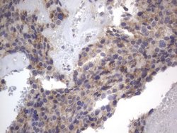 DDOST Monoclonal Antibody (OTI2B4), TrueMAB , OriGene 100 &mu;L; Unconjugated:Antibodies,