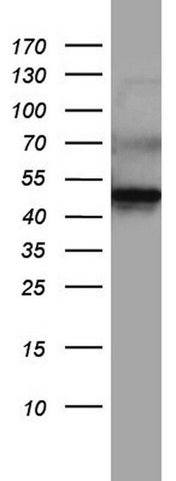 DDOST Monoclonal Antibody (OTI1C1), TrueMAB , OriGene:Antibodies:Primary