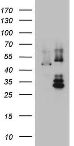 DDOST Monoclonal Antibody (OTI2H1), TrueMAB , OriGene 100 &mu;L; Unconjugated:Antibodies,