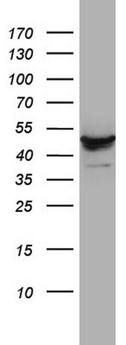 DDOST Monoclonal Antibody (OTI2H1), TrueMAB , OriGene 100 &mu;L; Unconjugated:Antibodies,
