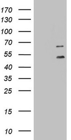 DDOST Monoclonal Antibody (OTI2B4), TrueMAB , OriGene 100 &mu;L; Unconjugated:Antibodies,