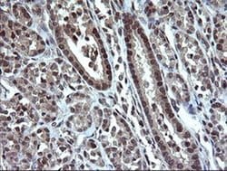 DDT Monoclonal Antibody (OTI3B10), TrueMAB , OriGene 100 &mu;L; Unconjugated:Antibodies,
