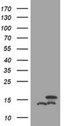 DDT Monoclonal Antibody (OTI1B1), TrueMAB , OriGene 30 &mu;L; Unconjugated:Antibodies,