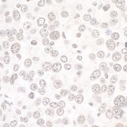DDX1 Rabbit anti-Human, Mouse, Polyclonal, Bethyl Laboratories 100 &mu;L;
