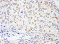 DDX1 Rabbit anti-Human, Polyclonal, Bethyl Laboratories 100 &mu;L; Unconjugated:Antibodies,