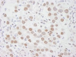 DDX1 Polyclonal Antibody, Bethyl Laboratories 10 &mu;L | Buy Online | Bethyl Laboratories, Inc | Fisher Scientific