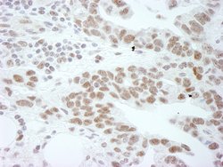 DDX1 Polyclonal Antibody, Bethyl Laboratories 10 &mu;L | Buy Online | Bethyl Laboratories, Inc | Fisher Scientific