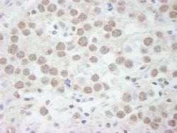 DDX17 Polyclonal Antibody, Bethyl Laboratories 100 &mu;L; Unconjugated:Antibodies,