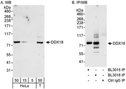 DDX18 Rabbit anti-Human, Polyclonal, Bethyl Laboratories 100 &mu;L; Unconjugated:Antibodies,