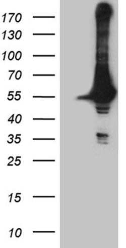 DDX19A Monoclonal Antibody (OTI3C12), TrueMAB , OriGene 30 &mu;L | Buy Online | Origene Technologies | Fisher Scientific