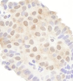 DDX20 Rabbit anti-Human, Polyclonal, Bethyl Laboratories 100 &mu;l; Unlabeled:Antibodies,