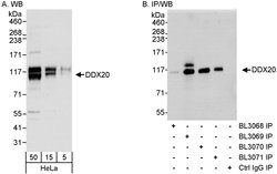 DDX20 Rabbit anti-Human, Polyclonal, Bethyl Laboratories 100 &mu;l; Unlabeled:Antibodies,