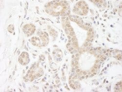 DDX20 Polyclonal Antibody, Bethyl Laboratories 100 &mu;L; Unconjugated:Antibodies,