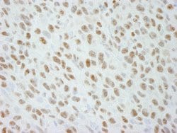DDX21 Polyclonal Antibody, Bethyl Laboratories:Antibodies:Primary Antibodies