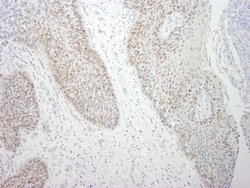 DDX21 Polyclonal Antibody, Bethyl Laboratories 100 &mu;l; Unlabeled:Antibodies,