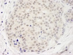DDX23 Polyclonal Antibody, Bethyl Laboratories 10 &mu;L; Unconjugated:Antibodies,