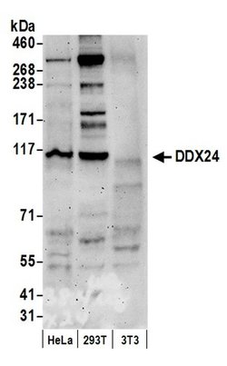 DDX24 Rabbit anti-Human, Polyclonal, Bethyl Laboratories 100 &mu;L; Unconjugated:Antibodies,