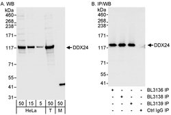 DDX24 Rabbit anti-Human, Polyclonal, Bethyl Laboratories 100 &mu;L; Unconjugated:Antibodies,