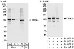 DDX24 Rabbit anti-Human, Polyclonal, Bethyl Laboratories 100 &mu;L; Unconjugated:Antibodies,