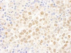 DDX27 Polyclonal Antibody, Bethyl Laboratories 100 &mu;L; Unconjugated:Antibodies,