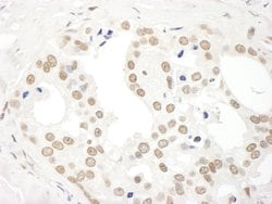 DDX27 Polyclonal Antibody, Bethyl Laboratories 100 &mu;L; Unconjugated:Antibodies,
