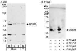 DDX28 Rabbit anti-Human, Polyclonal, Bethyl Laboratories 100 &mu;L; Unconjugated:Antibodies,