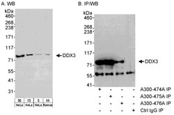 DDX3 Rabbit anti-Human, Polyclonal, Bethyl Laboratories 100 &mu;L; Unconjugated:Antibodies,