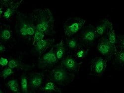 DDX39B Mouse anti-Canine, Human, Rat, Clone: OTI2E4, lyophilized, TrueMAB 100 &mu;g | Buy Online | OriGene | Fisher Scientific