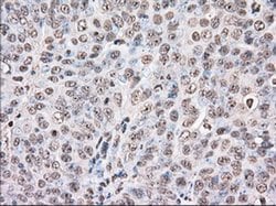 DDX39B Monoclonal Antibody (OTI2C5), TrueMAB , OriGene 30 &mu;L; Unconjugated:Antibodies,