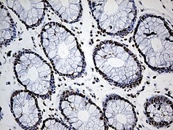 DDX39B Monoclonal Antibody (OTI7H4), TrueMAB , OriGene 100 &mu;L | Buy Online | OriGene | Fisher Scientific