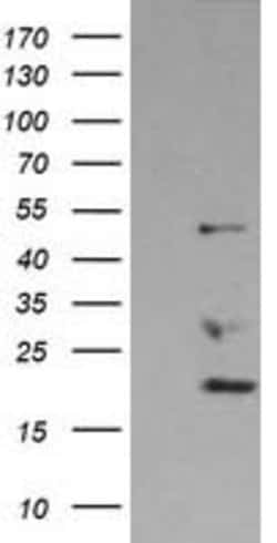 DDX39B Mouse anti-Canine, Human, Rat, Clone: OTI2E4, lyophilized, TrueMAB 100 &mu;g | Buy Online | OriGene | Fisher Scientific